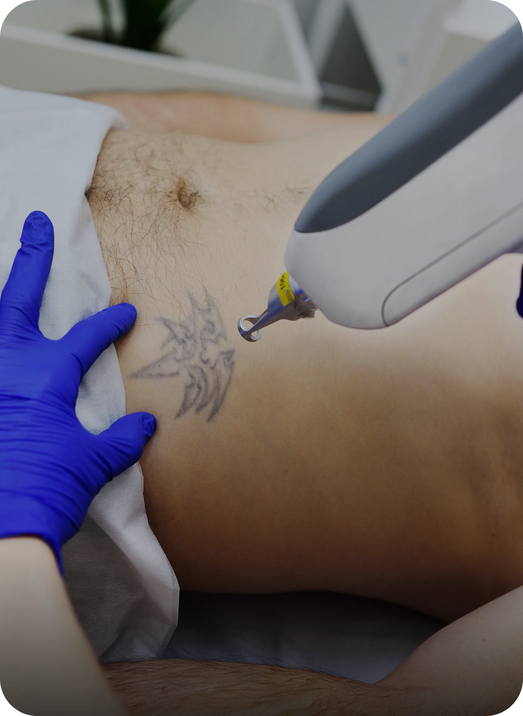 Specialized Treatments