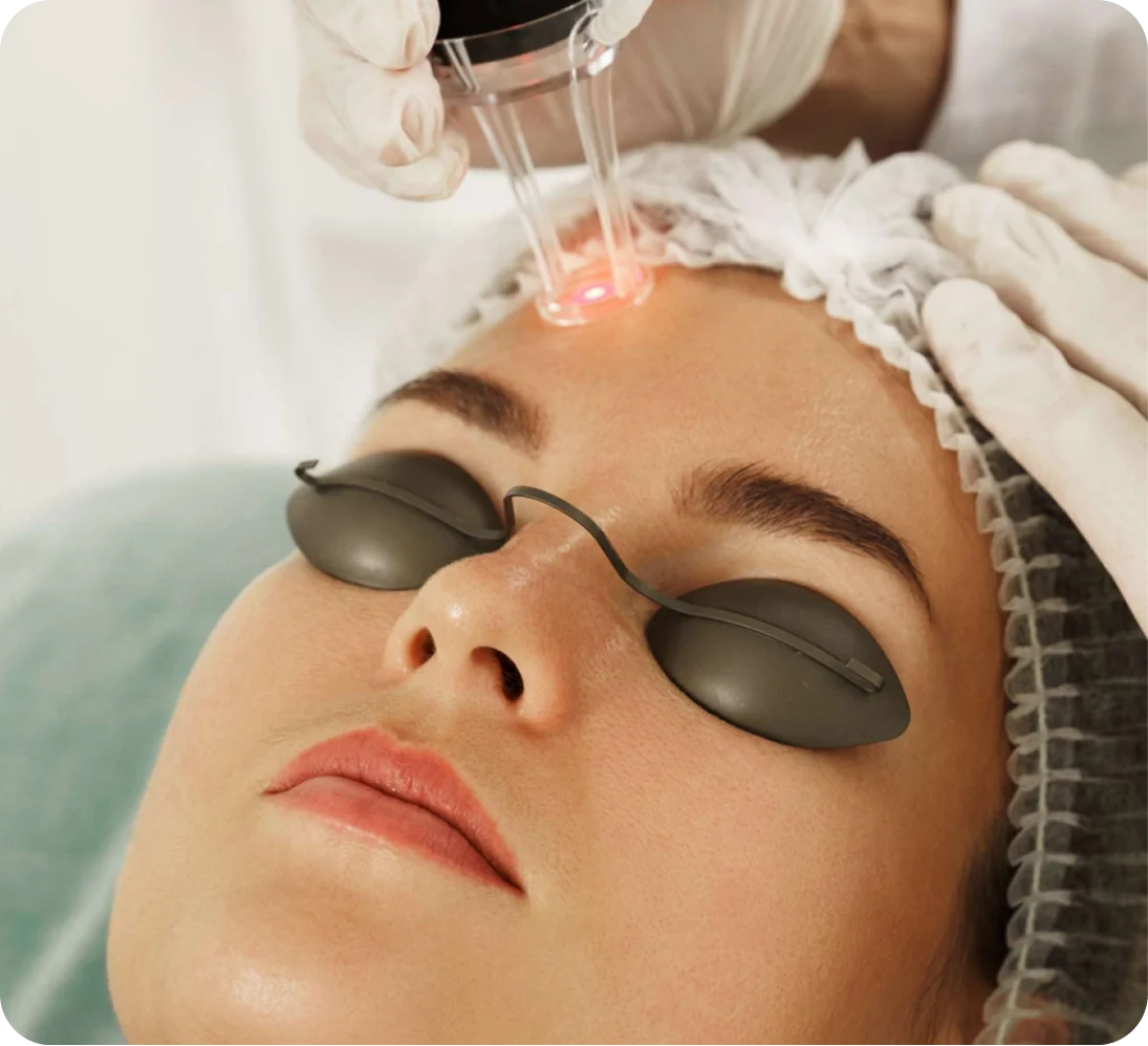 Male Hair Transplant