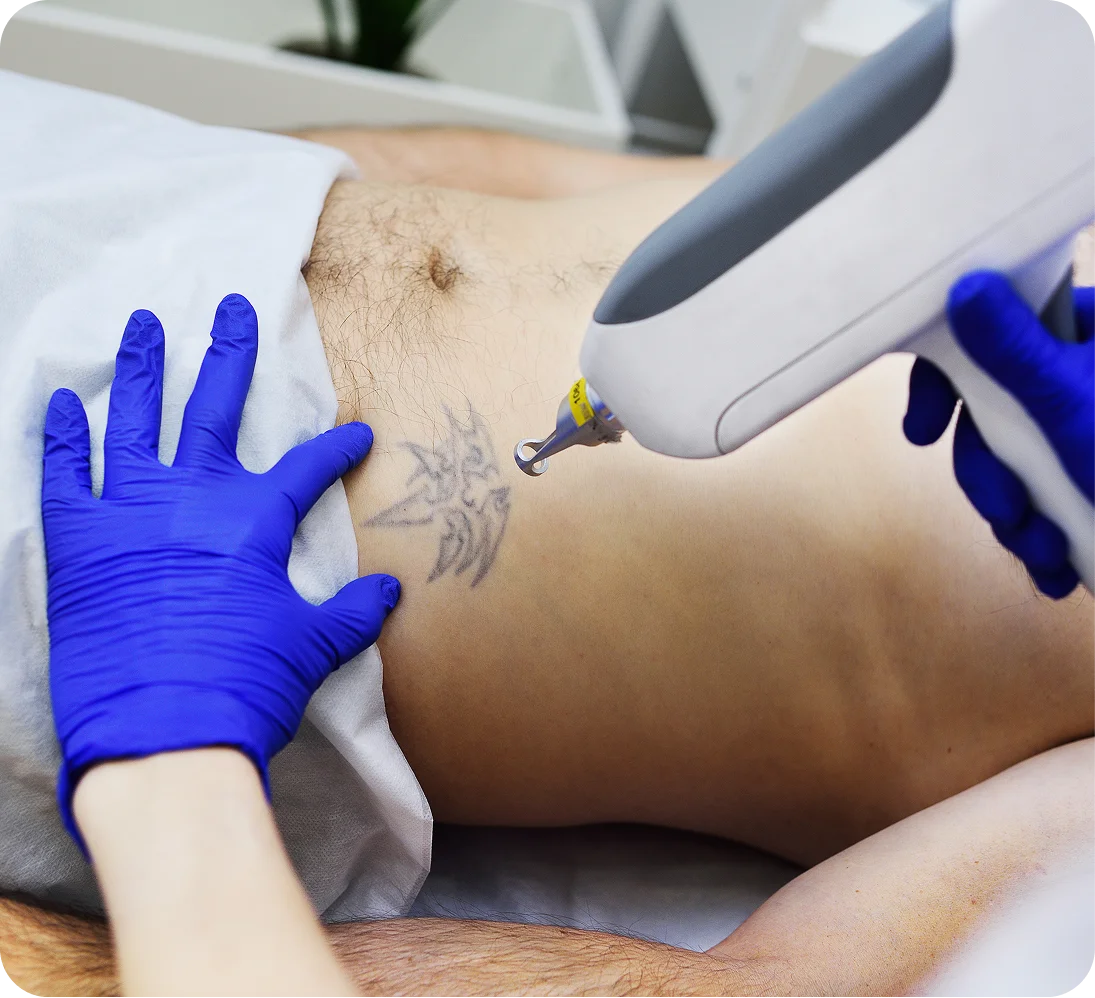 Male Hair Transplant