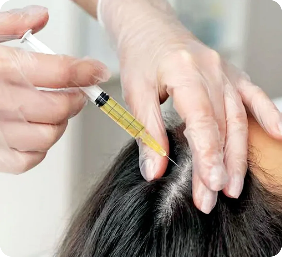 SVF Hair Therapy