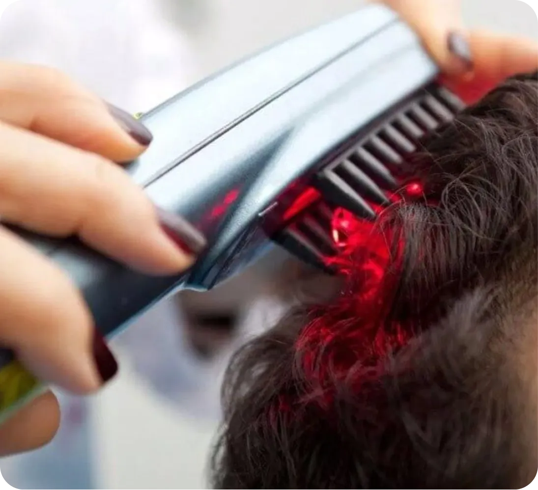 Laser Hair Therapy (LLLT)