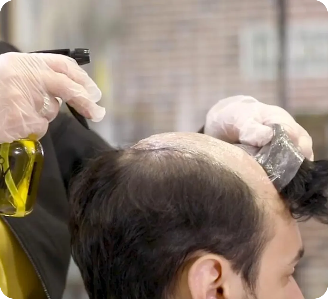 Hair System Maintenance